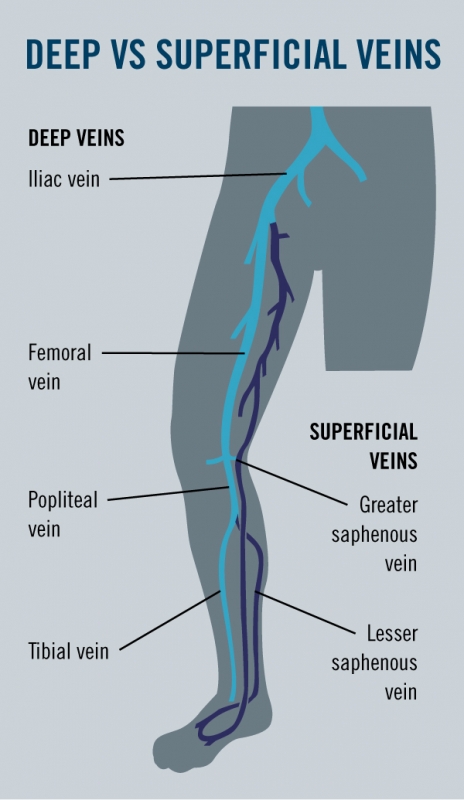 Deep vs Superficial Veins