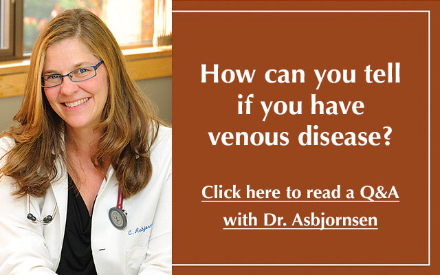 Do I have Venous Disease